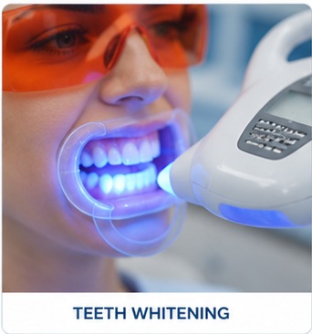 Teeth Whitening dental treatment illustration